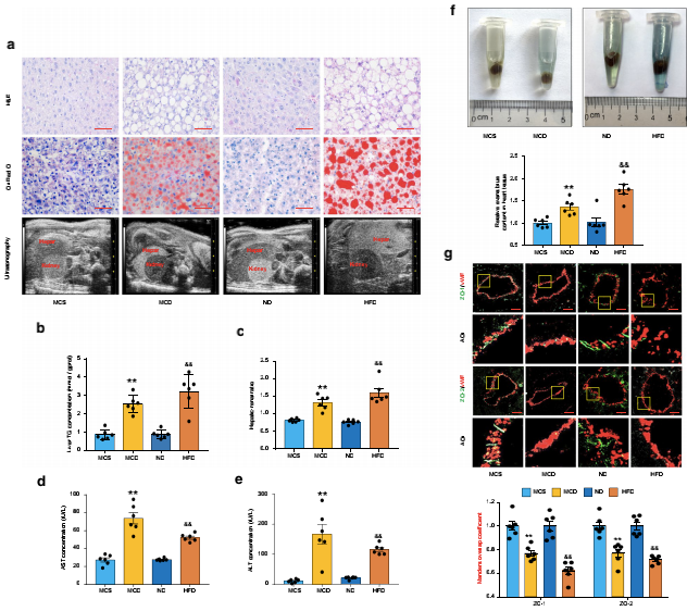 NAFLD小鼠冠狀動(dòng)脈微血管內(nèi)皮通透性增強(qiáng)